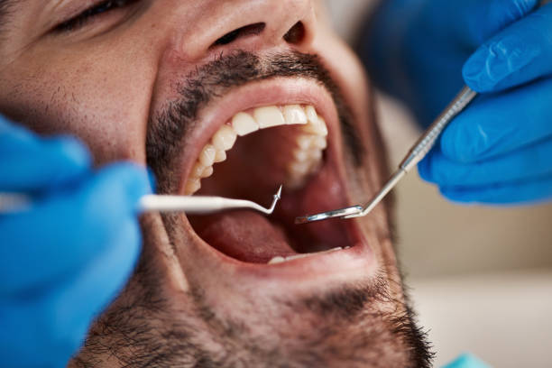 Best Root Canal Treatment  in Forney, TX