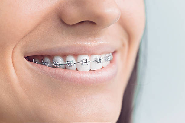 Best Tooth Extraction  in Forney, TX
